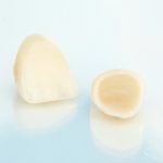 Crowns for Teeth in Lakewood Ranch FL area